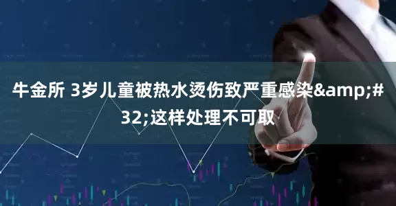 牛金所 3岁儿童被热水烫伤致严重感染&#32;这样处理不可取